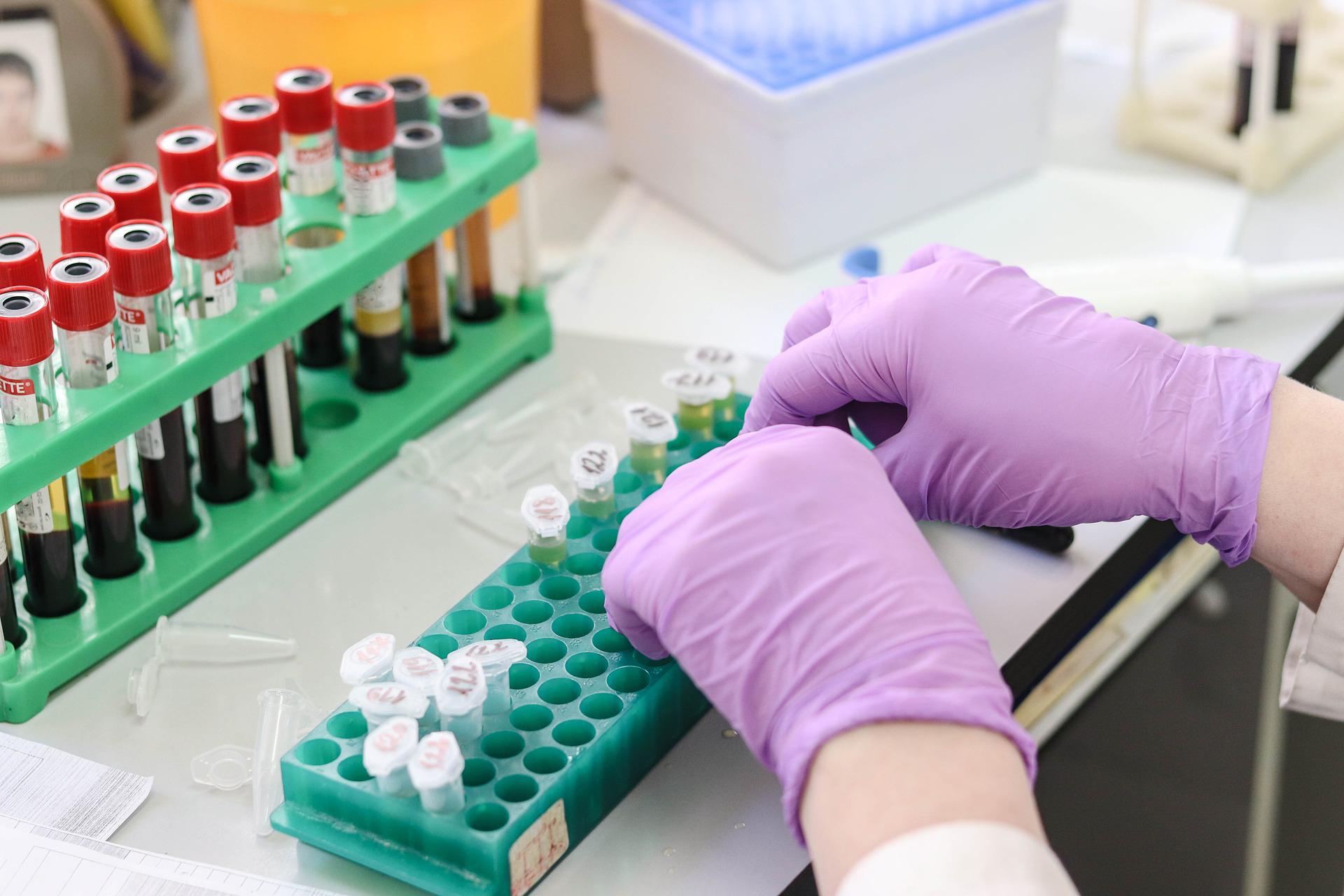 laboratory-g5fd4df2d7_1920.jpg